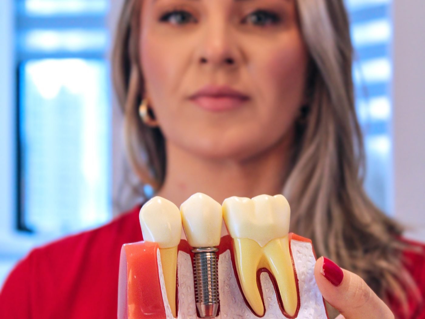 Dra. Iolanda Schroeder com um modelo de implante dentário
