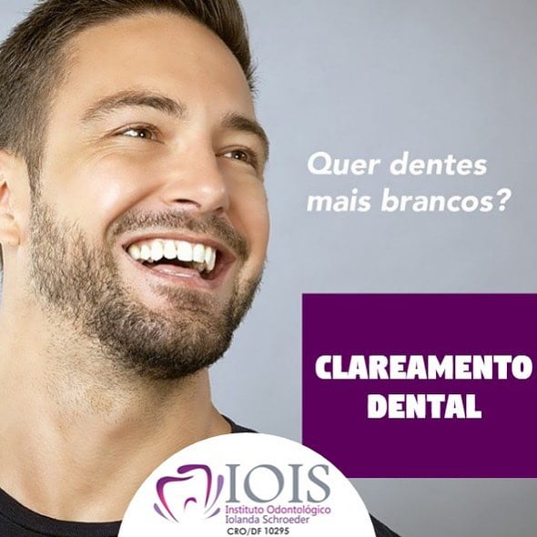 Clareamento Dental